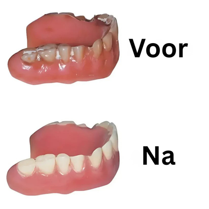 Blissali Denture Dome