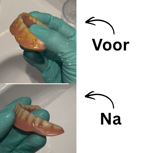 Blissali Denture Dome