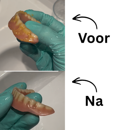 Blissali Denture Dome